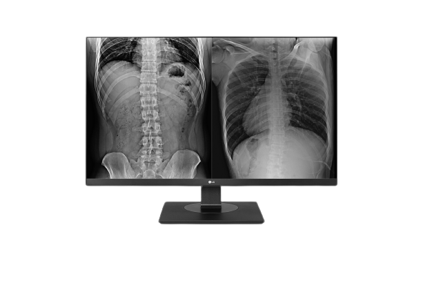 Monitor Medicali LG serie Clinical Review - 27HJ713C