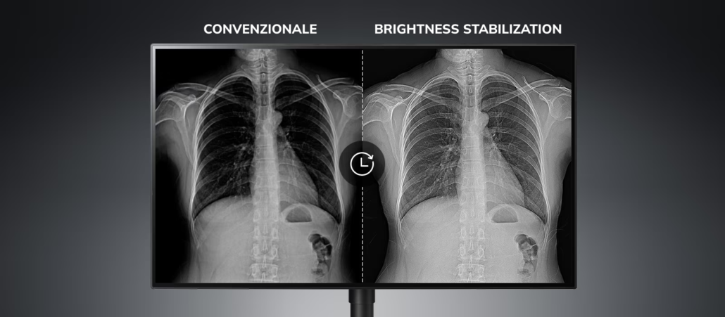 Monitor LG compatibili con DICOM Part 14 e Stabilizzazione della luminosità