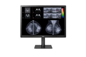 Monitor Medicali LG serie Diagnostic - 31HN713D