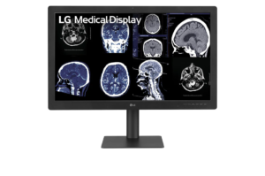 Monitor Medicali LG serie Diagnostic - 32HQ713D