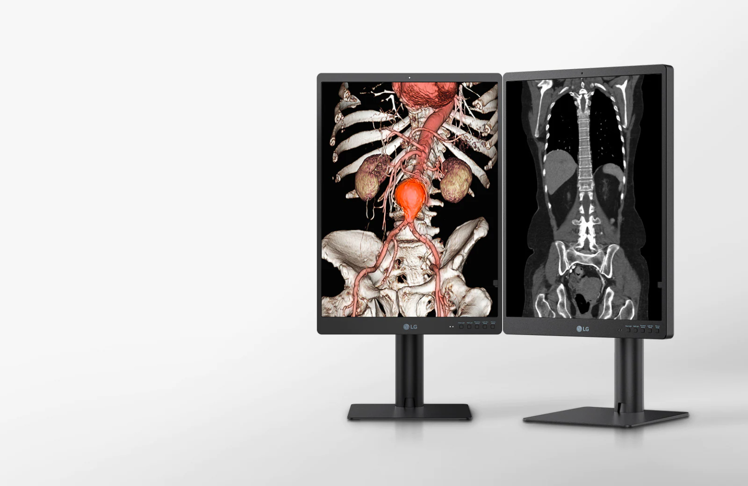 Monitor Diagnostico LG, modello 21hq513d, 3MP e display IPS