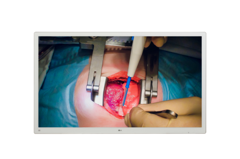 LG 55'' 4K IPS Surgical Monitor Monitor per Sala Operatoria