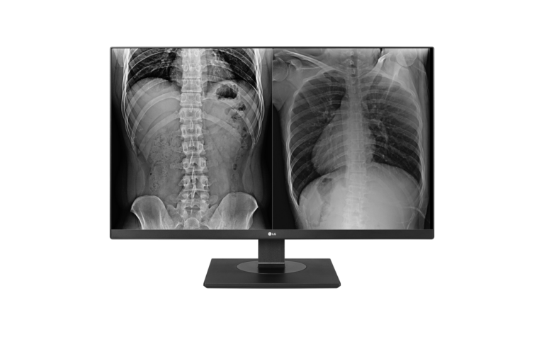 LG Monitor di refertazione clinica 27″ 8MP