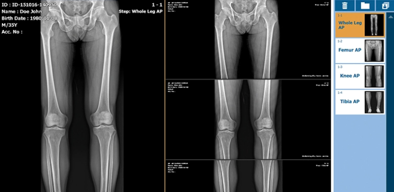 Software VXvue Vieworks Radiologia Umana