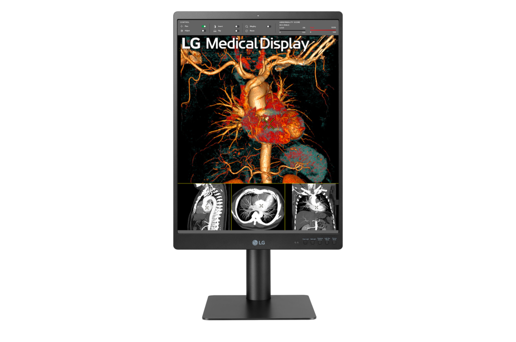 LG Monitor Diagnostico 21″ 3MP