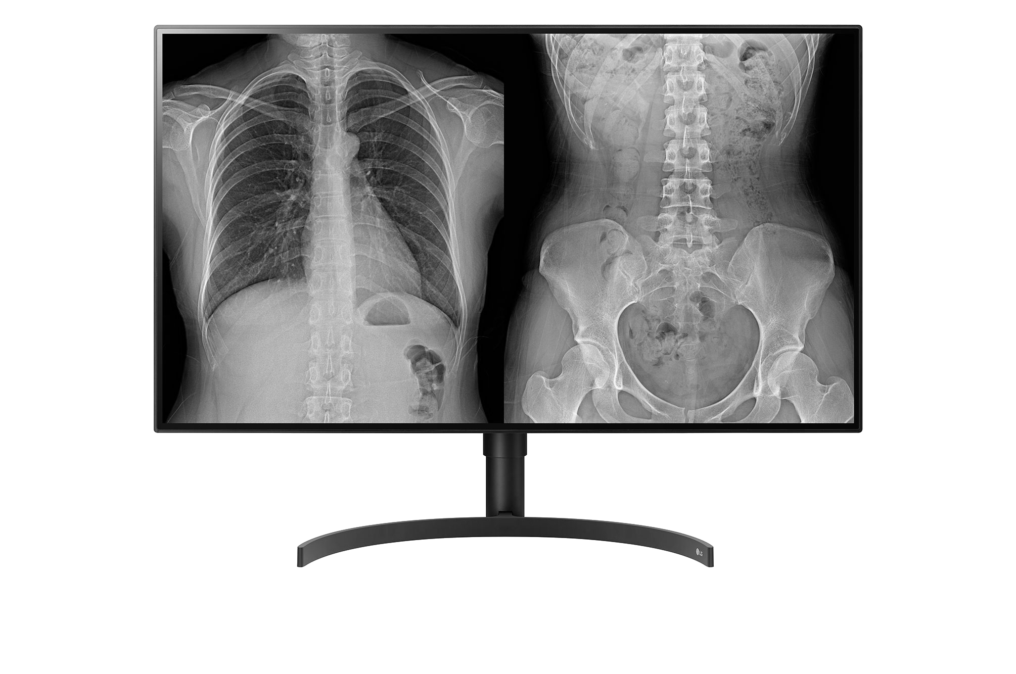 LG Monitor Diagnostico 32″ 8MP IPS
