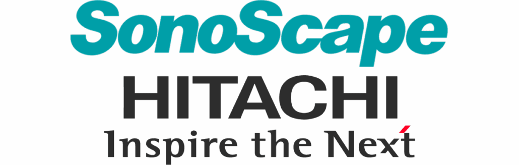 Sonoscape Hitachi ecografi portatili